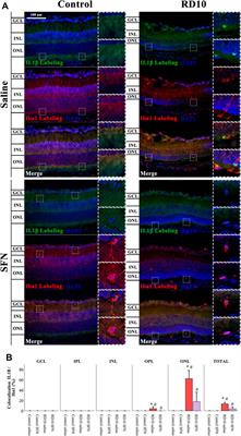 Sulforaphane Modulates the Inflammation and Delays Neurodegeneration on a Retinitis Pigmentosa Mice Model